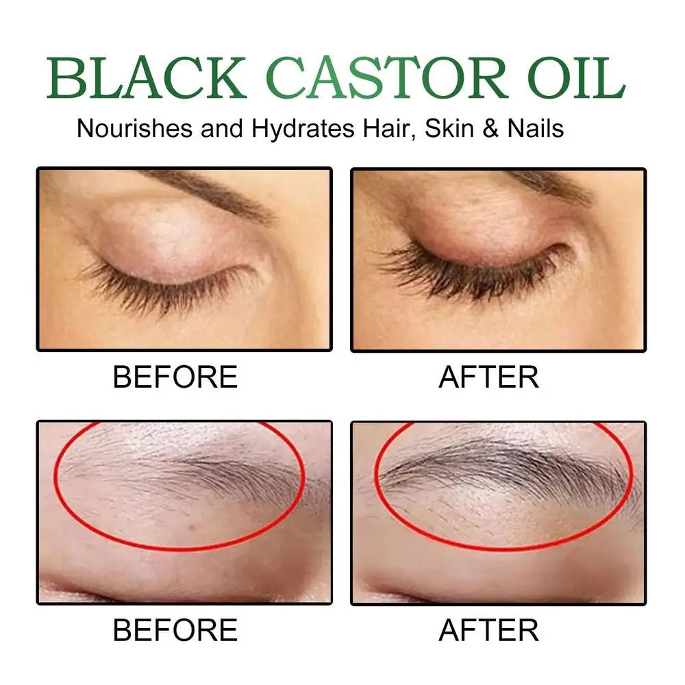 Black Castor Oil Hair Growth Jamaican Scalp Dense Hair Strengthening Hair