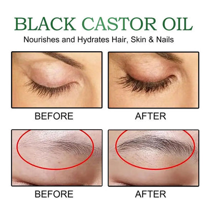 Black Castor Oil Hair Growth Jamaican Scalp Dense Hair Strengthening Hair